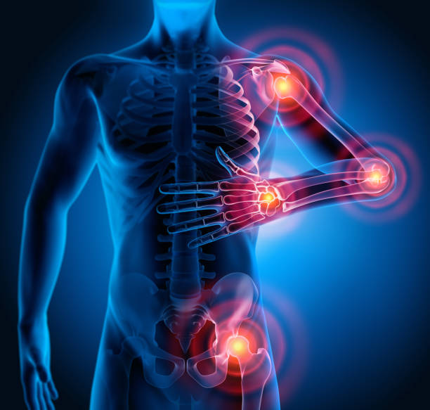 different joint pains around the body