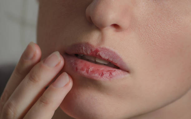 Common Concerns and Misconceptions about Mouth Taping