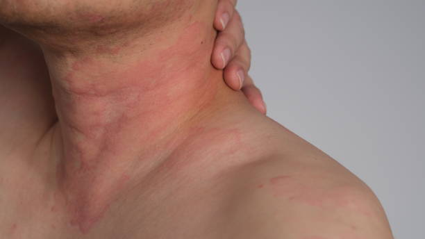 Potential Side Effects and Precautions