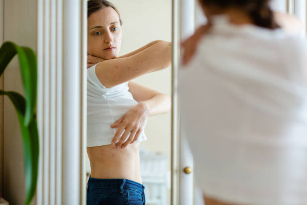 Understanding the Symptoms of Psoriasis