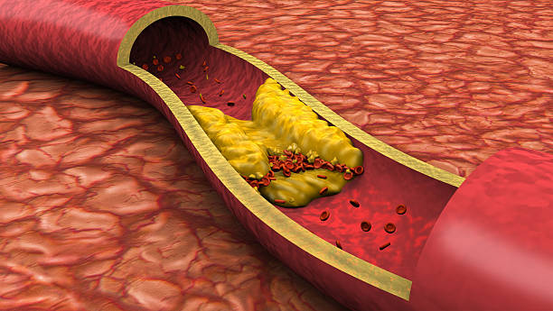 Cholesterol and its impact