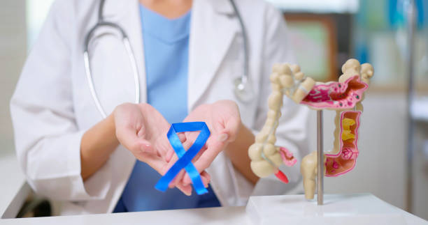 Colon cancer