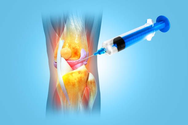Long-term healing and tissue regrowth can be helped by stem cells.