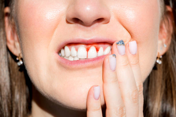 Symptoms of Gum Inflammation