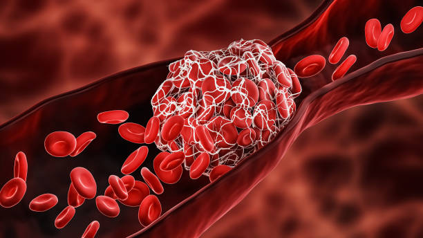 Blood clotting
