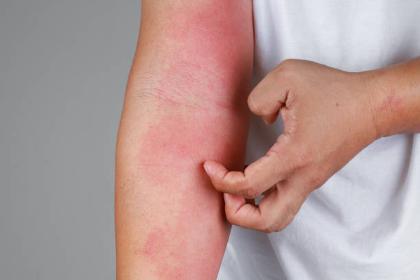 Potential Side Effects and Precautions