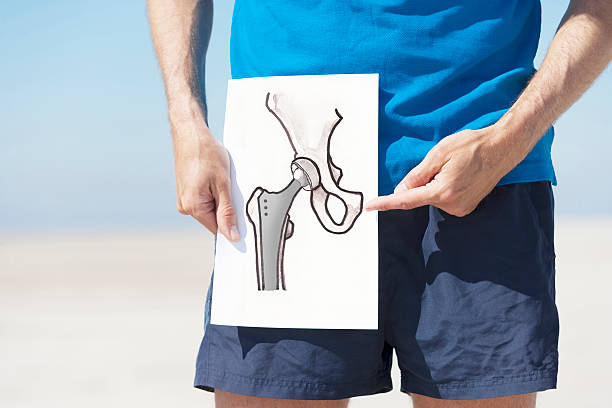 Planned joint replacement