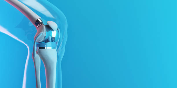 future of joint replacement