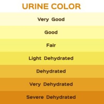 What Color Of Pee Means Dehydration