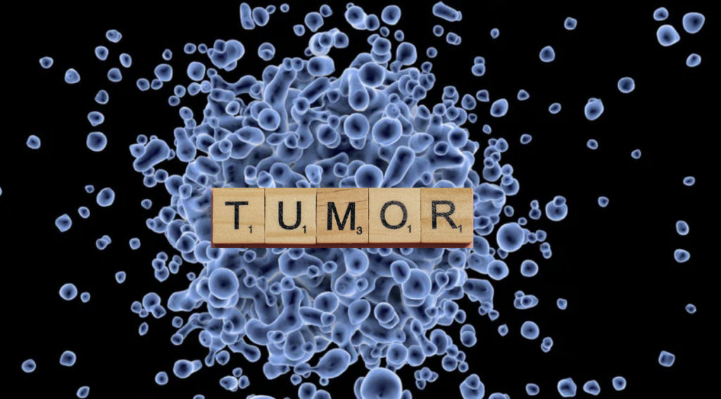 fat cells affecting tumor growth