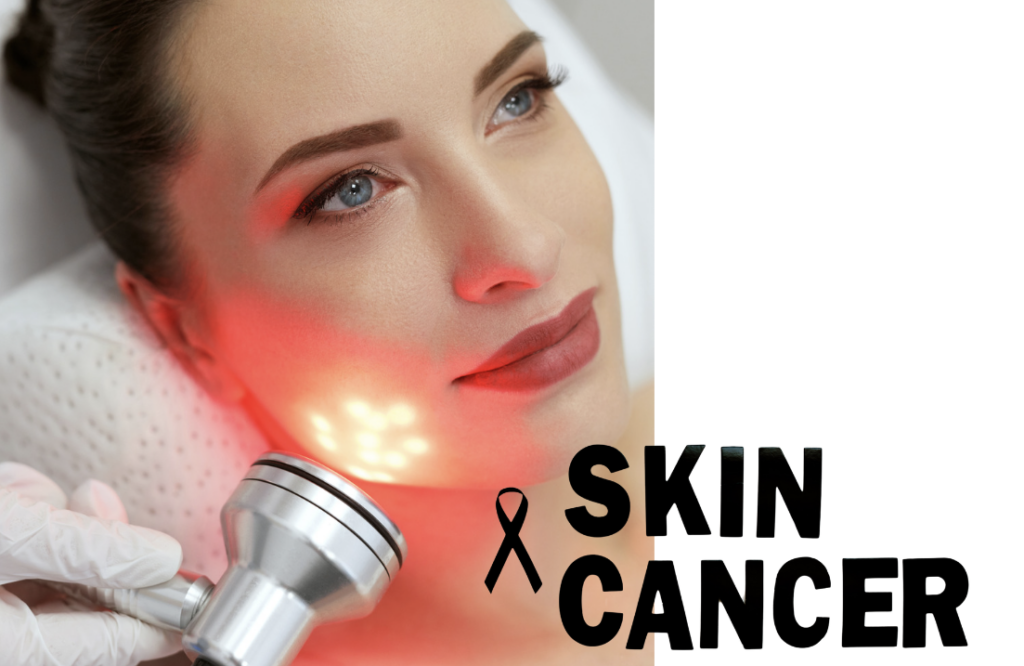 LED light therapy and skin cancer