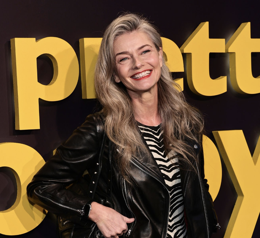 Paulina Porizkova Hip Dysplasia