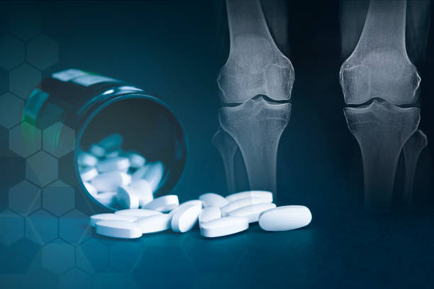 The Correlation Between Joint Supplements and Blood Thinning