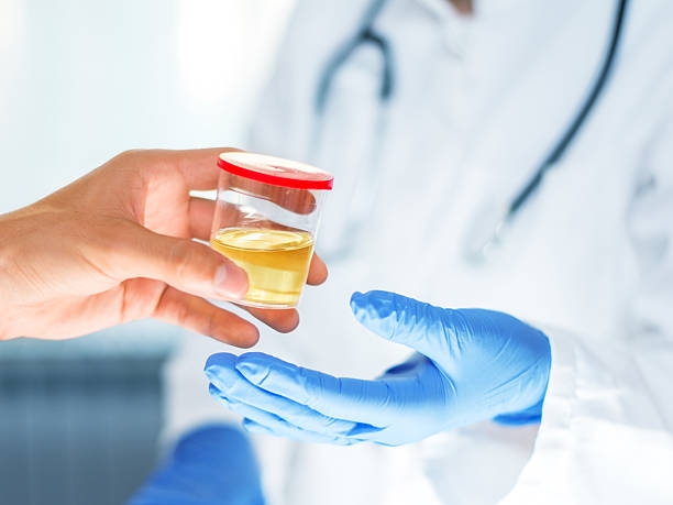 Understanding Urine Color