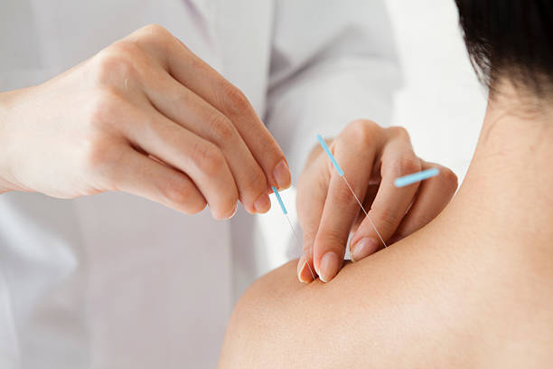 Understanding Acupuncture and Osteoarthritis