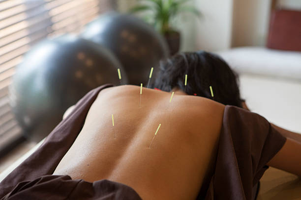 Comparing Acupuncture with Other Treatments