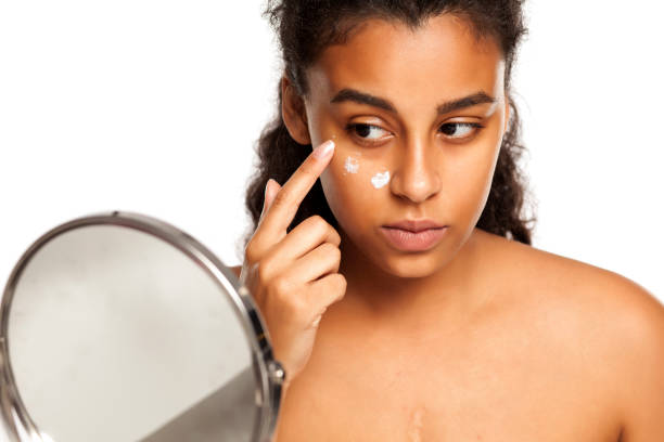 Popular Herbs for Treating Dark Circles