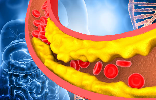 Understanding Cholesterol and Its Impact on Health