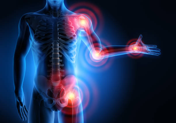 Understanding Inflammation and Its Causes