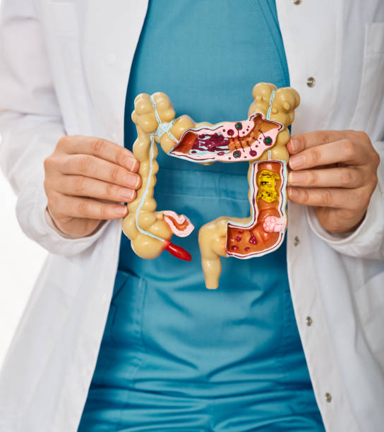 Common Gut Health Issues
