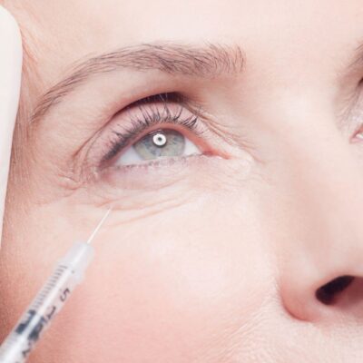 Can Fillers Actually Make Under Eye Bags Worse?