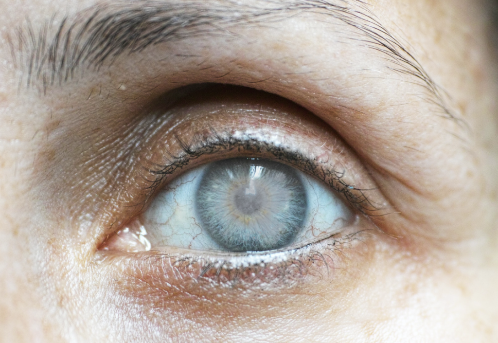 common eye conditions in seniors