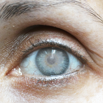 common eye conditions in seniors