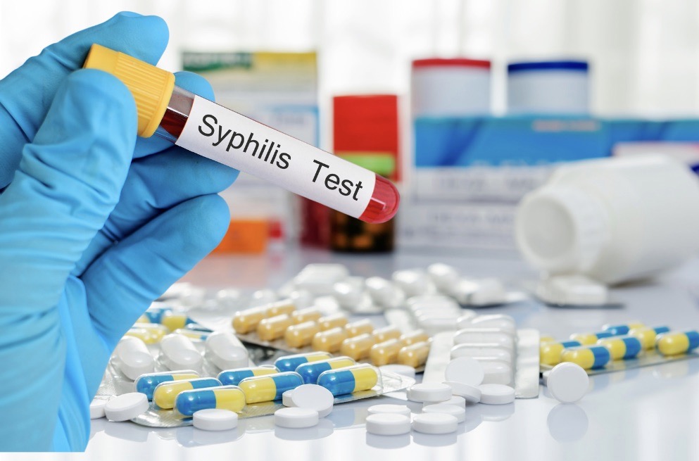 Treatment For Syphilis