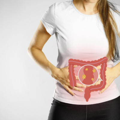 colon cancer in women