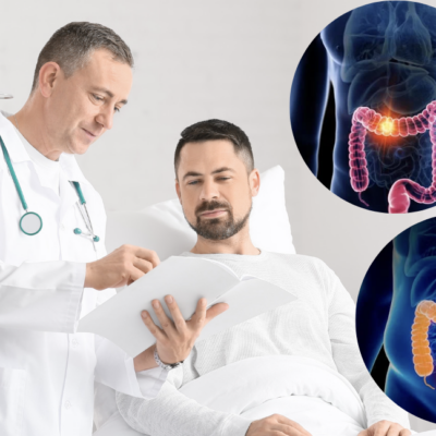 Recognizing the Stages and Symptoms of Colon Cancer