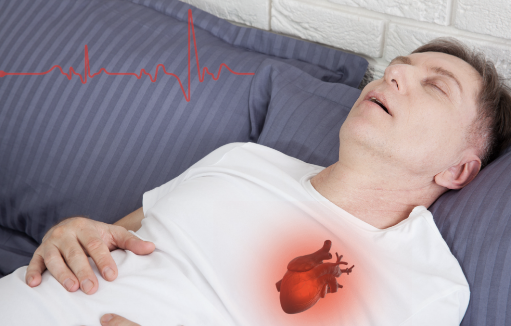 How Sleep Apnea and Heart Failure are Linked