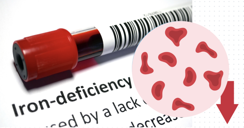 Surprising Causes Of Iron Deficiency