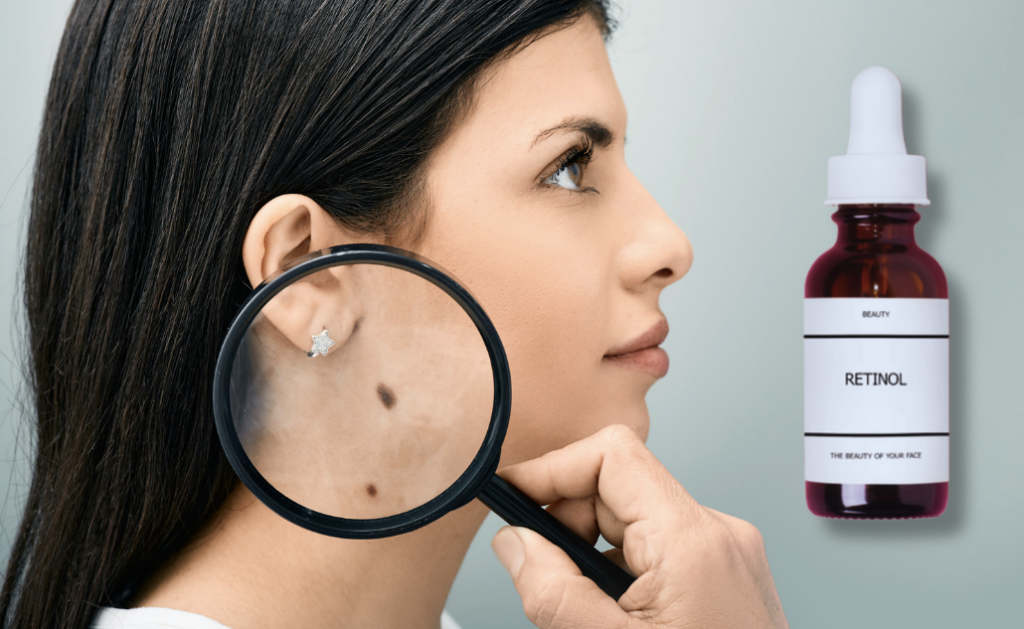 Learn How Retinol May Increase Skin Cancer Risk