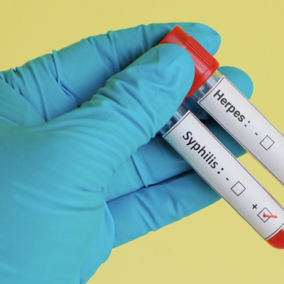 Breaking Down the Distinctions: Syphilis vs. Herpes 