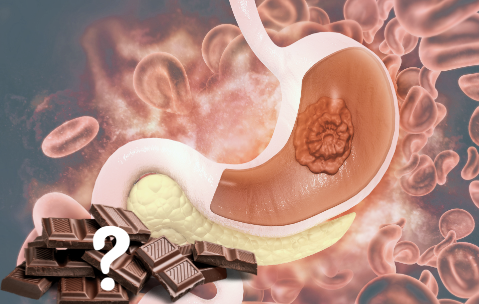 Is Chocolate Really Bad for Stomach Ulcers?