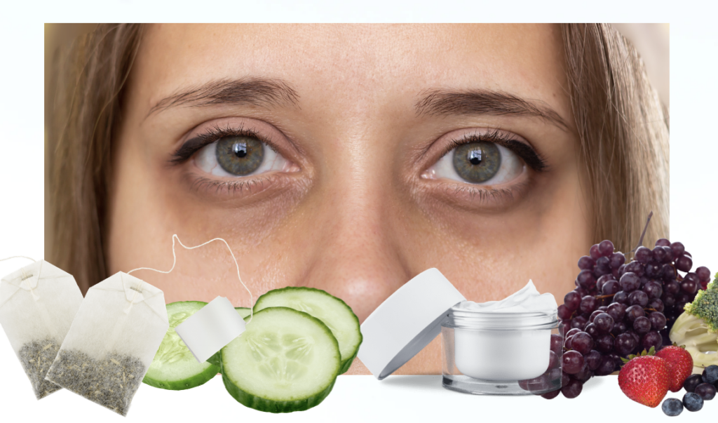 Say Goodbye To Dark Under Eyes With Natural Solutions