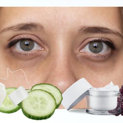 Say Goodbye To Dark Under Eyes With Natural Solutions