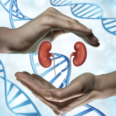 Common Genetic Factors Associated with Kidney Stones