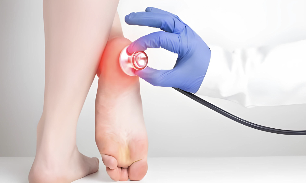 What Are Effective Treatments for Plantar Fasciitis
