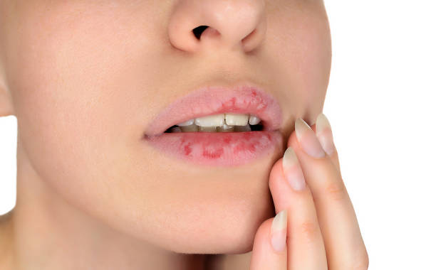 Dehydration and Skin Health