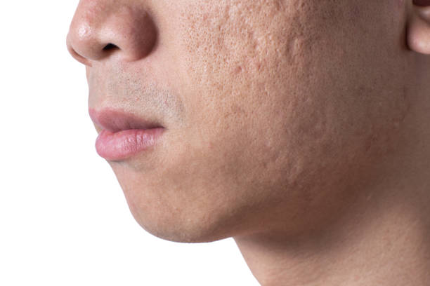 Addressing Specific Skin Concerns