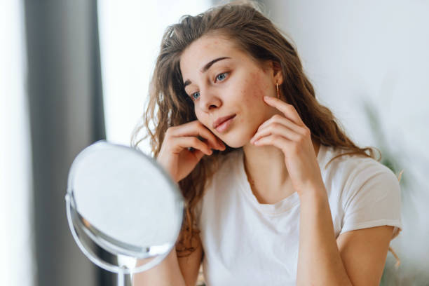 Understanding Skin Types and Concerns