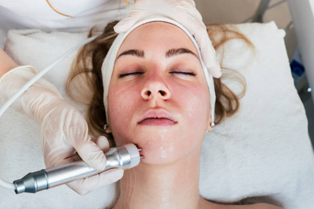 These treatments can be used in conjunction with pigmentation creams or on their own to improve the appearance of hyperpigmentation.