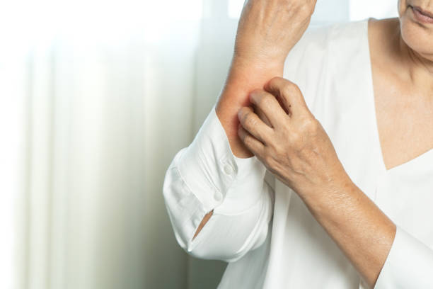 Common Causes of Dry, Itchy Skin in the Elderly