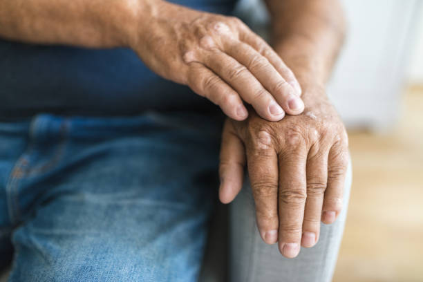 Natural Remedies for Dry, Itchy Skin in the Elderly