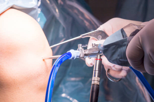 Treatment Options for Frozen Shoulder
