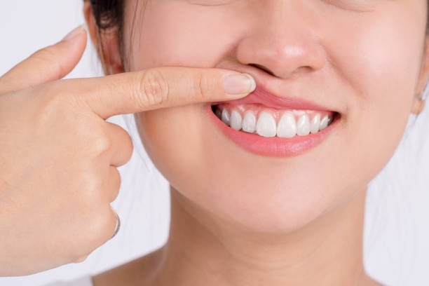 Role of Supplements in Oral Health