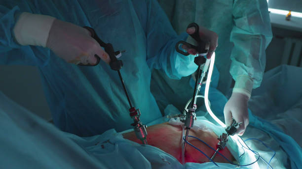 Understanding Gallbladder Removal