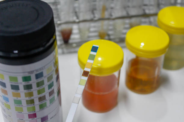 Individuals with urinary incontinence frequently develop urinary tract infections (UTIs).