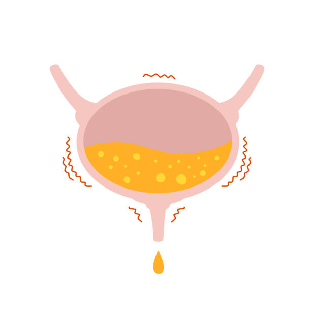 Constipation has a considerable impact on bladder control and is one of the primary causes of urinary incontinence.